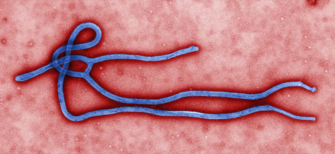 Colorized electron micrograph of a filamentous Ebola virus particle
